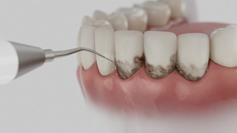 Trusted Dental Crowns And Bridges service in Wooster, OH - Dentist Open Now